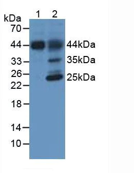 Western blot - Anti-Hemojuvelin antibody [C6] (AB239495)