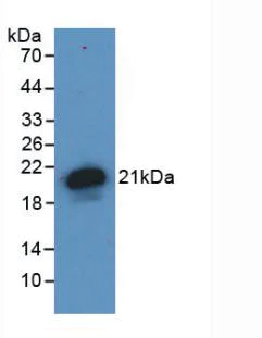 Western blot - Anti-Hemojuvelin antibody [C6] (AB239495)