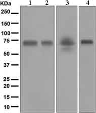 Western blot - Anti-Hemopexin antibody [EPR5609] (AB133523)