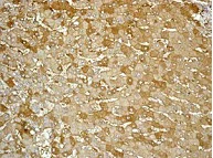 Immunohistochemistry (Formalin/PFA-fixed paraffin-embedded sections) - Anti-Hemopexin antibody [EPR5610] - BSA and Azide free (AB226099)
