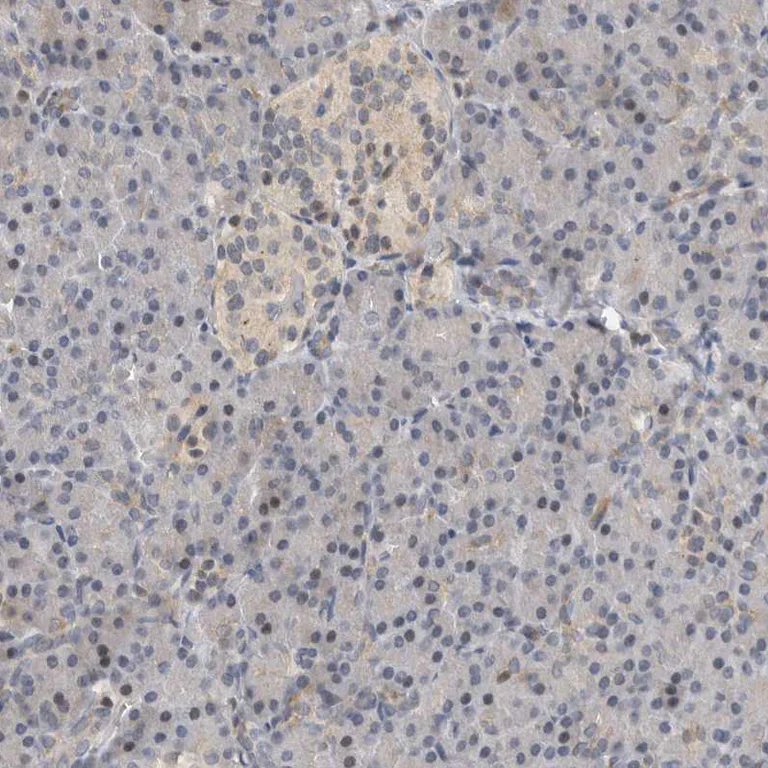 Immunohistochemistry (Formalin/PFA-fixed paraffin-embedded sections) - Anti-HENMT1 antibody (AB121991)