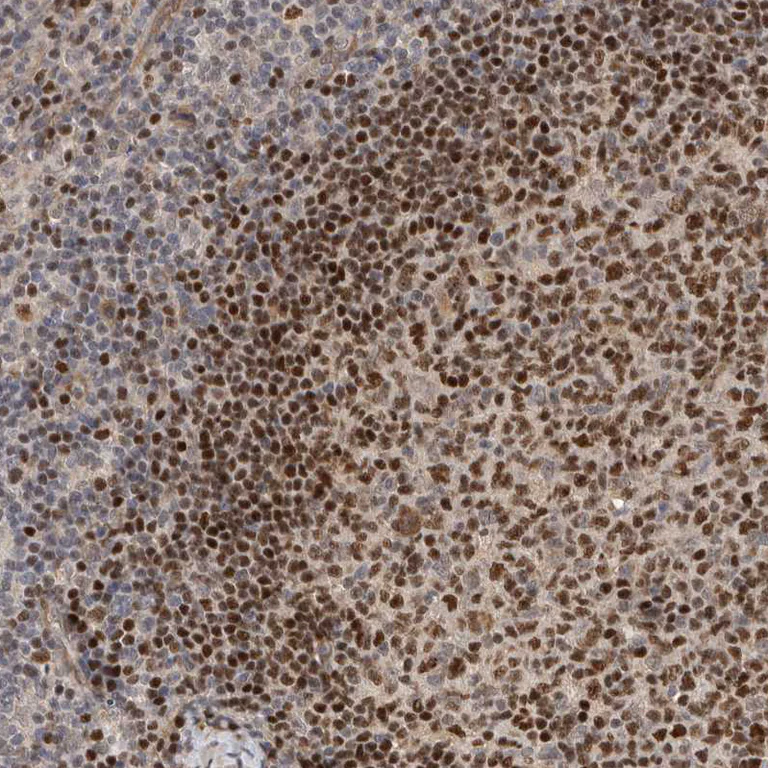 Immunohistochemistry (Formalin/PFA-fixed paraffin-embedded sections) - Anti-HENMT1 antibody (AB121991)