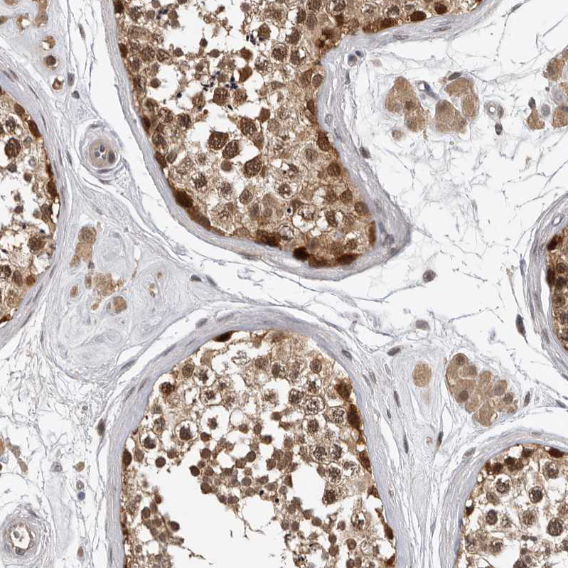Immunohistochemistry (Formalin/PFA-fixed paraffin-embedded sections) - Anti-HENMT1 antibody (AB121991)