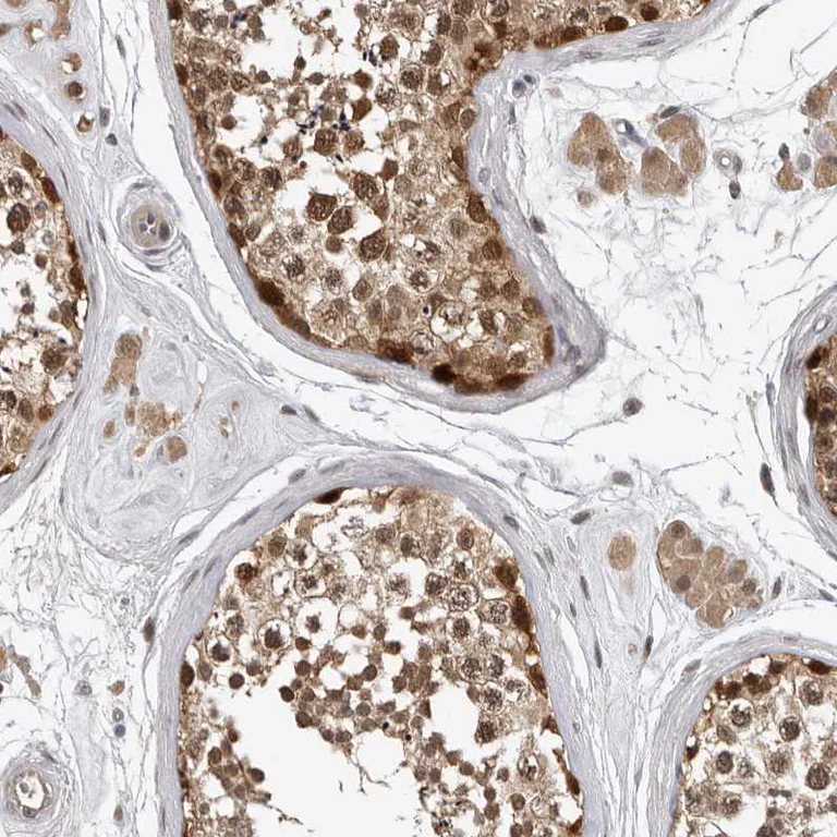Immunohistochemistry (Formalin/PFA-fixed paraffin-embedded sections) - Anti-HENMT1 antibody (AB121991)