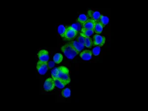 Immunocytochemistry/ Immunofluorescence - Anti-HEPACAM antibody [EPR11217] (AB172635)