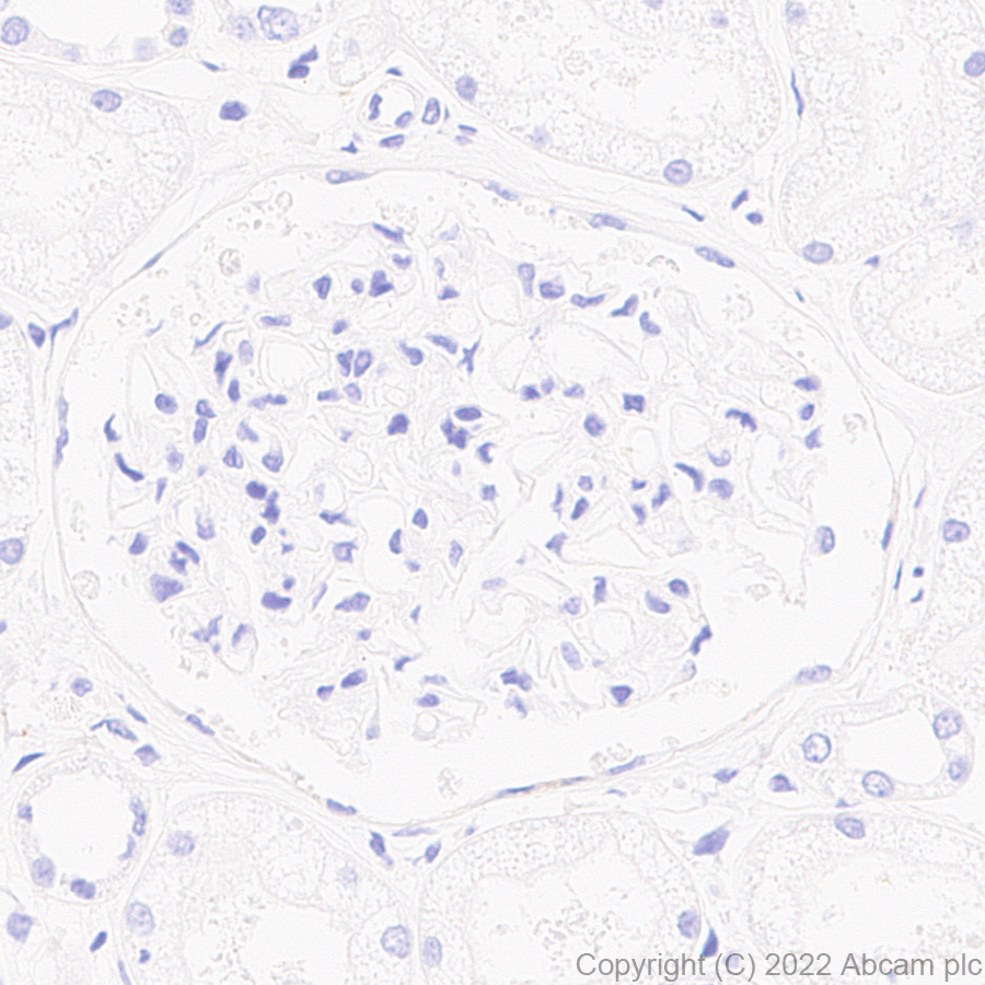 Immunohistochemistry (Formalin/PFA-fixed paraffin-embedded sections) - Anti-HEPACAM antibody [EPR25296-150] (AB300571)