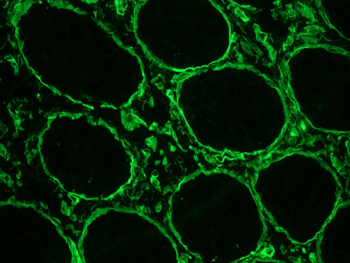 Immunohistochemistry (Frozen sections) - Anti-Heparan Sulfate Proteoglycan 2/Perlecan antibody [A7L6] (AB2501), expandable thumbnail