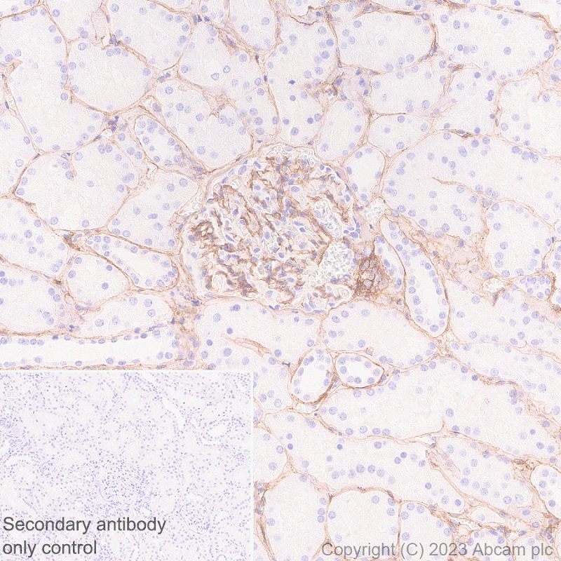Immunohistochemistry (Formalin/PFA-fixed paraffin-embedded sections) - Anti-Heparan Sulfate Proteoglycan 2/Perlecan antibody [EPR28345-62] - BSA and Azide free (ab315241), expandable thumbnail