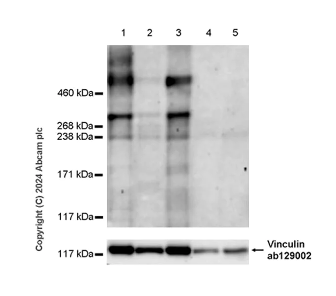 Western blot - Anti-Heparan Sulfate Proteoglycan 2/Perlecan antibody [RM2059] (AB318284)