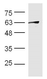 Western blot - Anti-Heparanase 1 antibody (AB228660)