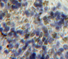 Immunohistochemistry (Formalin/PFA-fixed paraffin-embedded sections) - Anti-Heparanase 1 antibody (AB232817), expandable thumbnail