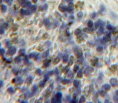 Immunohistochemistry (Formalin/PFA-fixed paraffin-embedded sections) - Anti-Heparanase 1 antibody (AB232817)