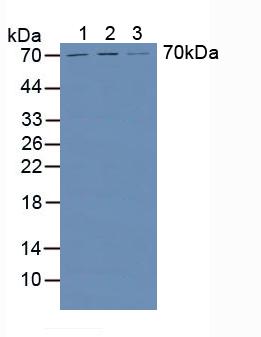 Western blot - Anti-Heparanase 1 antibody (AB232817), expandable thumbnail
