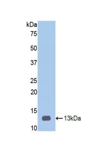 Western blot - Anti-Heparanase 1 antibody (AB232817), expandable thumbnail