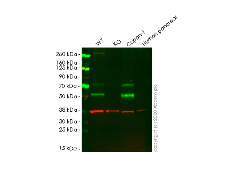 Western blot - Anti-Heparanase 1 antibody [EPR22365-230] - BSA and Azide free (AB255285)