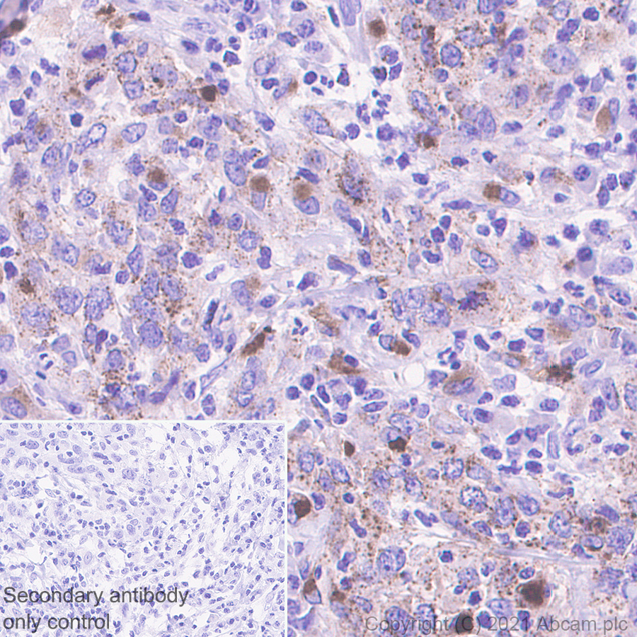 Immunohistochemistry (Formalin/PFA-fixed paraffin-embedded sections) - Anti-Heparanase 1 antibody [EPR25303-58] (ab288438), expandable thumbnail
