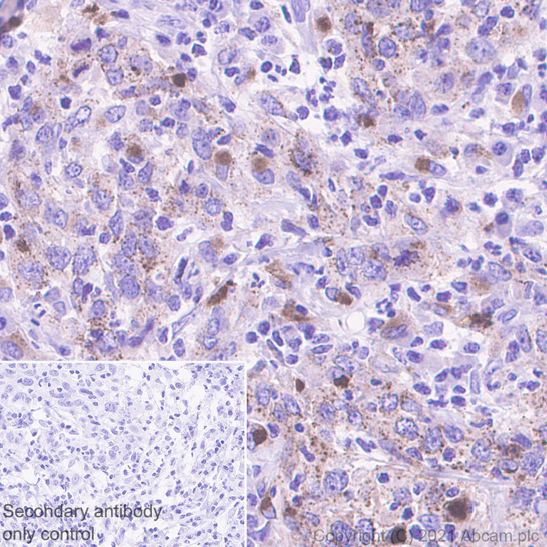 Immunohistochemistry (Formalin/PFA-fixed paraffin-embedded sections) - Anti-Heparanase 1 antibody [EPR25303-58] (AB288438)