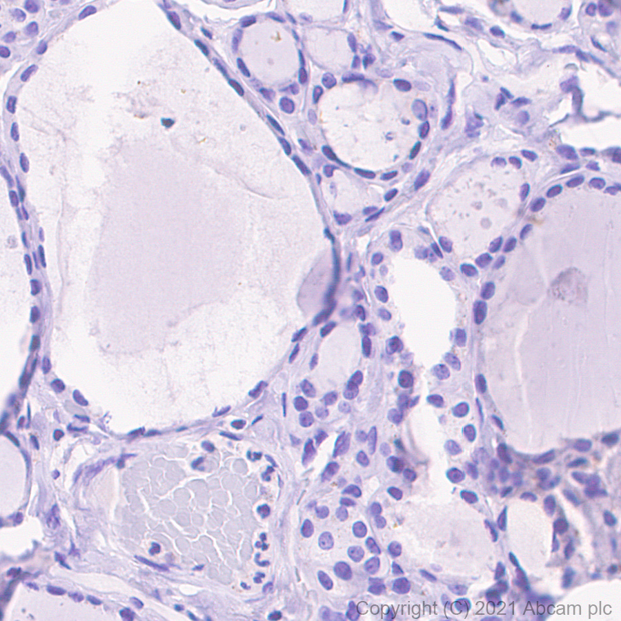 Immunohistochemistry (Formalin/PFA-fixed paraffin-embedded sections) - Anti-Heparanase 1 antibody [EPR25303-58] (ab288438), expandable thumbnail