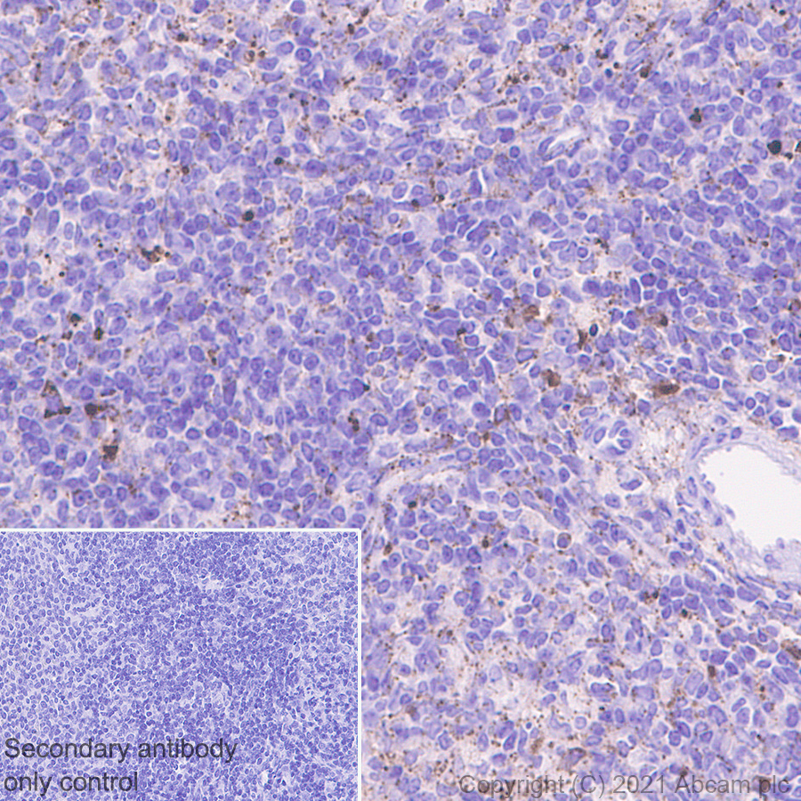 Immunohistochemistry (Formalin/PFA-fixed paraffin-embedded sections) - Anti-Heparanase 1 antibody [EPR25303-58] (ab288438), expandable thumbnail