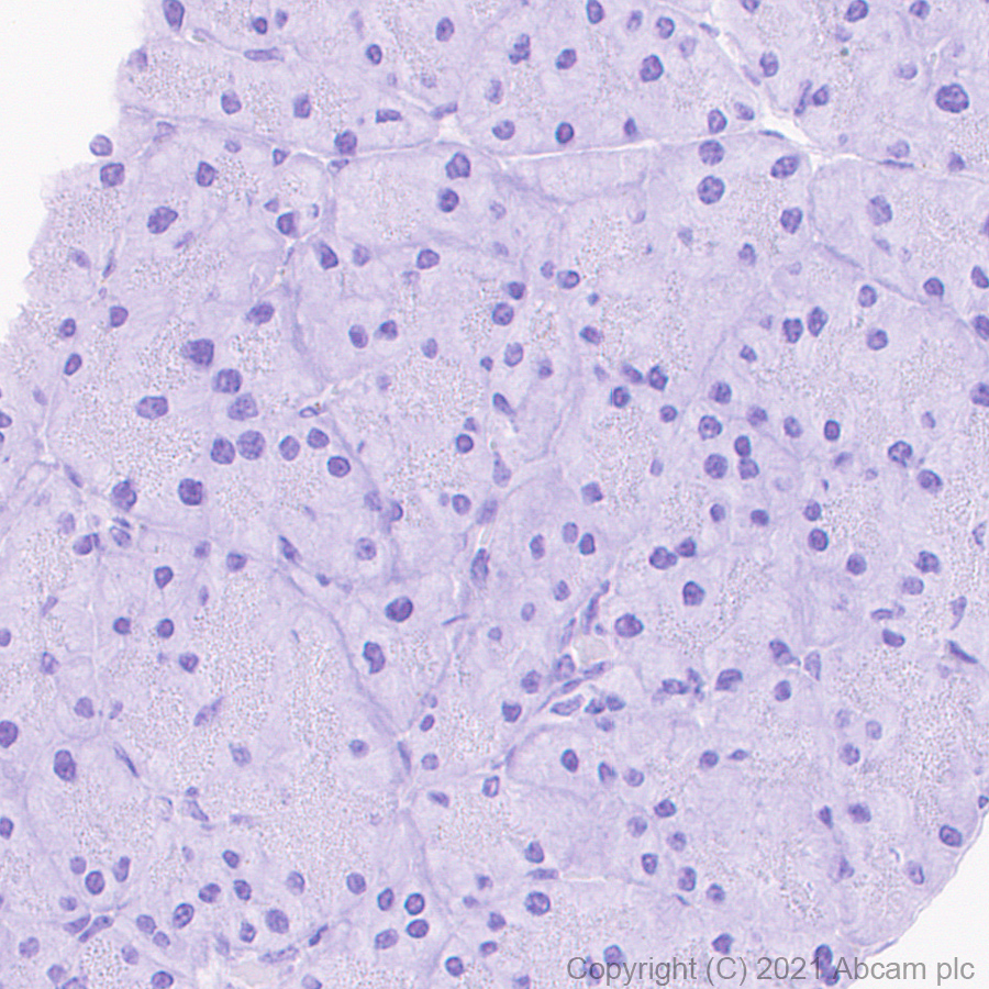 Immunohistochemistry (Formalin/PFA-fixed paraffin-embedded sections) - Anti-Heparanase 1 antibody [EPR25303-58] (ab288438), expandable thumbnail