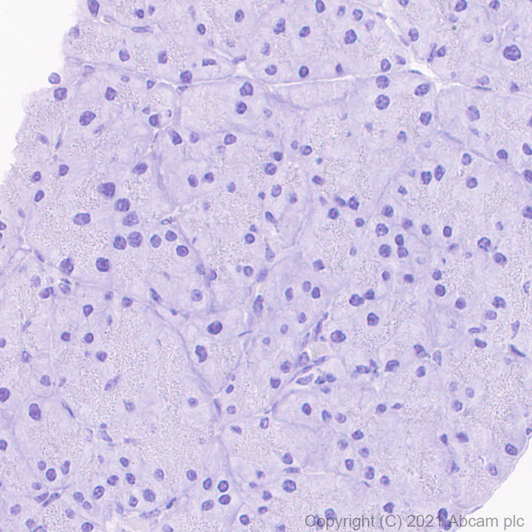 Immunohistochemistry (Formalin/PFA-fixed paraffin-embedded sections) - Anti-Heparanase 1 antibody [EPR25303-58] (AB288438)