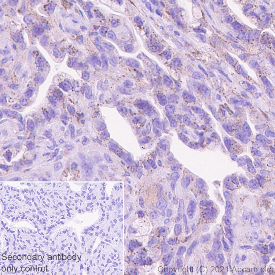 Immunohistochemistry (Formalin/PFA-fixed paraffin-embedded sections) - Anti-Heparanase 1 antibody [EPR25303-58] (ab288438), expandable thumbnail