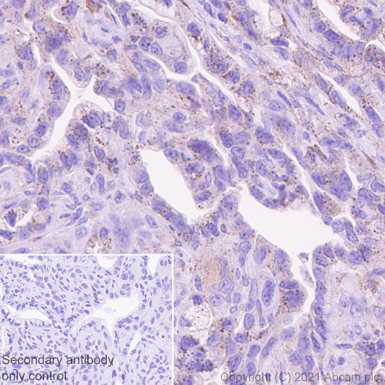 Immunohistochemistry (Formalin/PFA-fixed paraffin-embedded sections) - Anti-Heparanase 1 antibody [EPR25303-58] (AB288438)