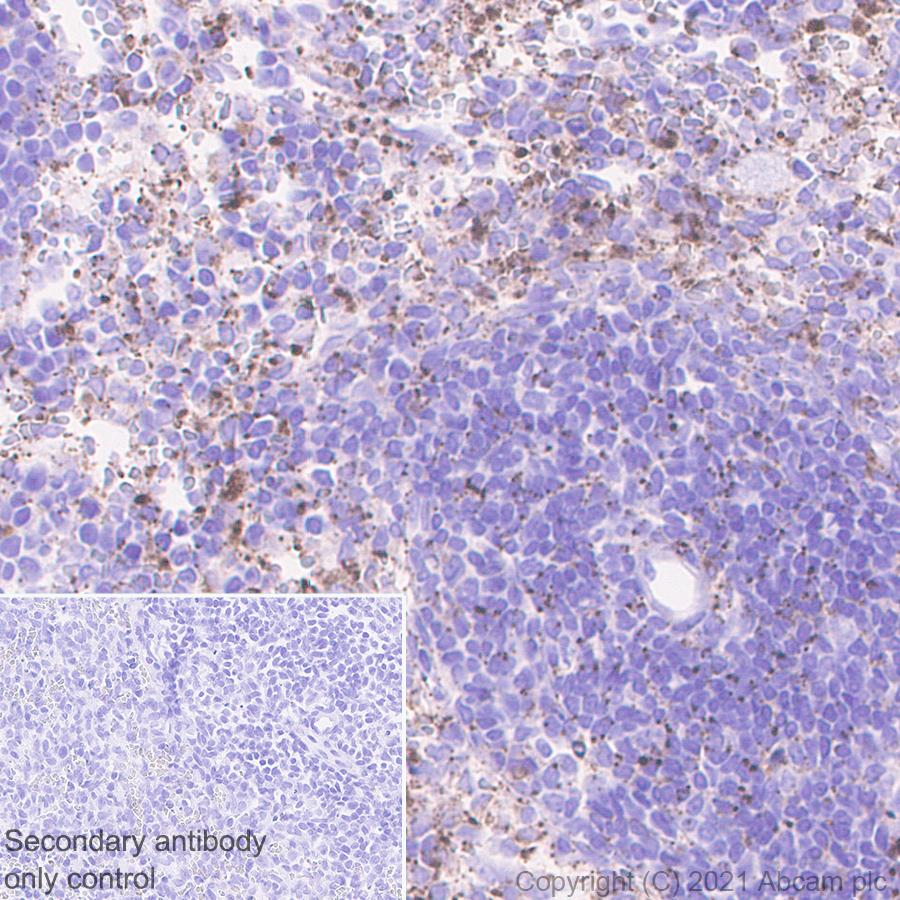 Immunohistochemistry (Formalin/PFA-fixed paraffin-embedded sections) - Anti-Heparanase 1 antibody [EPR25303-58] (ab288438), expandable thumbnail