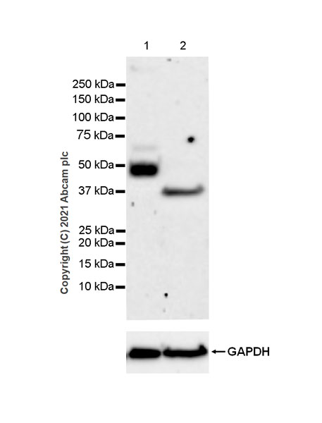Western blot - Anti-Heparanase 1 antibody [EPR25303-58] (ab288438), expandable thumbnail