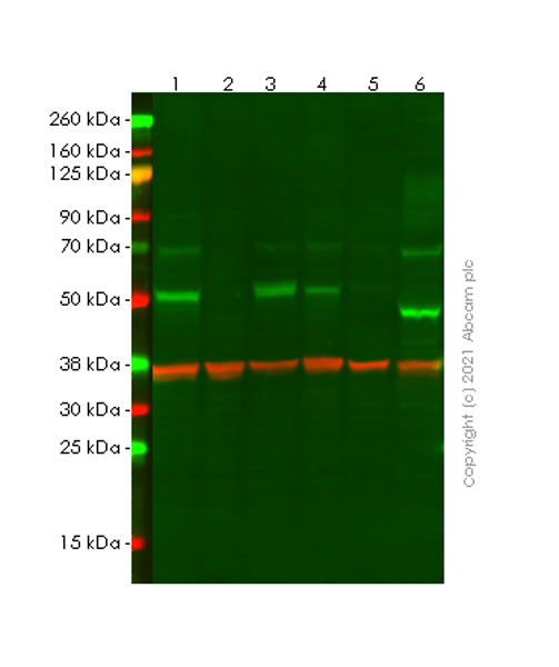 Western blot - Anti-Heparanase 1 antibody [EPR25303-58] (ab288438), expandable thumbnail