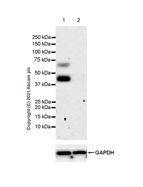 Western blot - Anti-Heparanase 1 antibody [EPR25303-58] (AB288438), expandable thumbnail