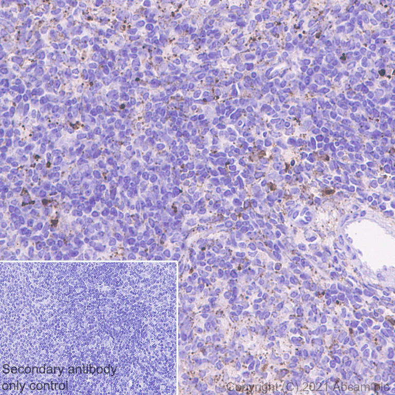 Immunohistochemistry (Formalin/PFA-fixed paraffin-embedded sections) - Anti-Heparanase 1 antibody [EPR25303-58] - BSA and Azide free (AB288447)