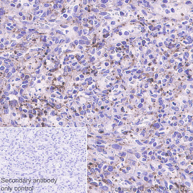 Immunohistochemistry (Formalin/PFA-fixed paraffin-embedded sections) - Anti-Heparanase 1 antibody [EPR25303-58] - BSA and Azide free (AB288447)