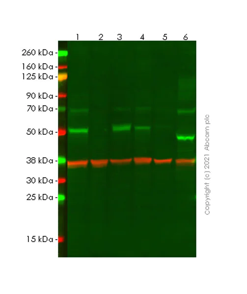Western blot - Anti-Heparanase 1 antibody [EPR25303-58] - BSA and Azide free (AB288447)