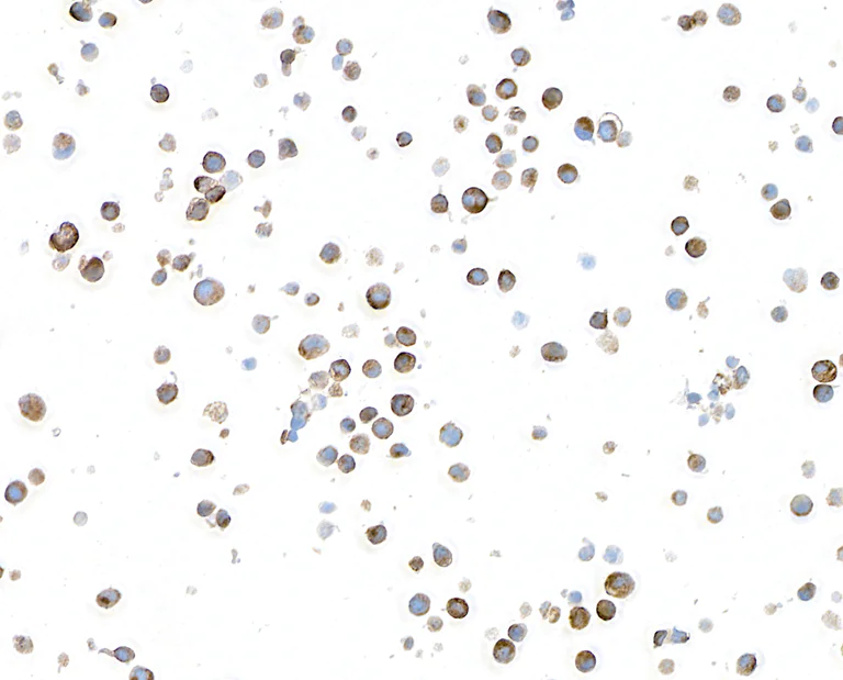 Immunocytochemistry - Anti-Hepassocin/FGL1 antibody [BLR210K] - BSA free (AB314078)