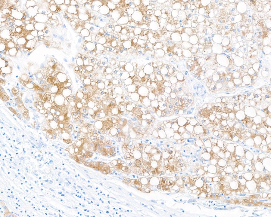 Immunohistochemistry (Formalin/PFA-fixed paraffin-embedded sections) - Anti-Hepassocin/FGL1 antibody [BLR210K] - BSA free (AB314078), expandable thumbnail