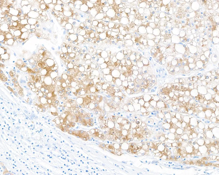 Immunohistochemistry (Formalin/PFA-fixed paraffin-embedded sections) - Anti-Hepassocin/FGL1 antibody [BLR210K] - BSA free (AB314078)