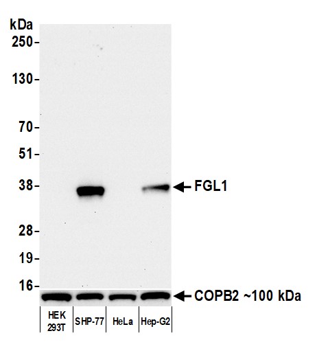 Western blot - Anti-Hepassocin/FGL1 antibody [BLR210K] - BSA free (AB314078), expandable thumbnail
