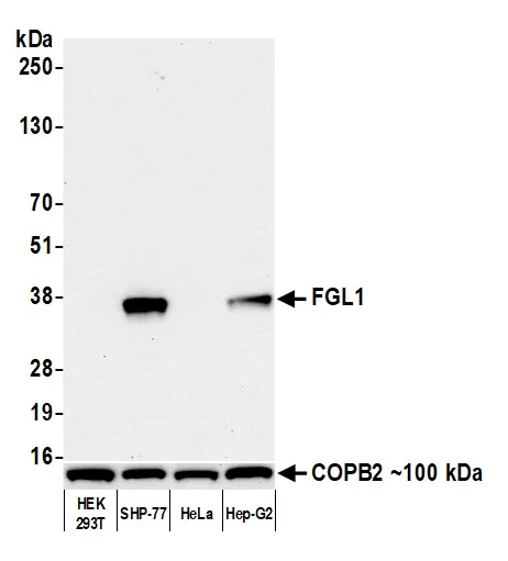 Western blot - Anti-Hepassocin/FGL1 antibody [BLR210K] - BSA free (AB314078)