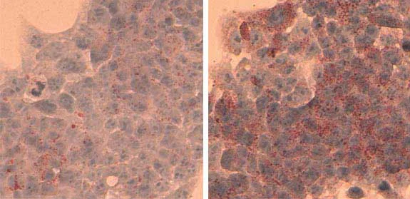 Functional Studies - Hepatic Lipid Accumulation/ Steatosis Assay Kit (AB133131)