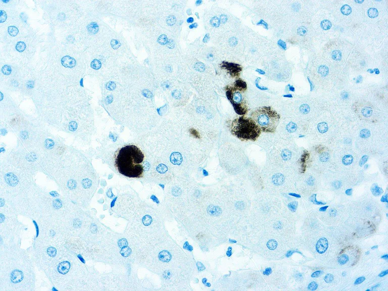 Immunohistochemistry (Formalin/PFA-fixed paraffin-embedded sections) - Anti-Hepatitis B Surface Antigen antibody [5C3] (AB277481)