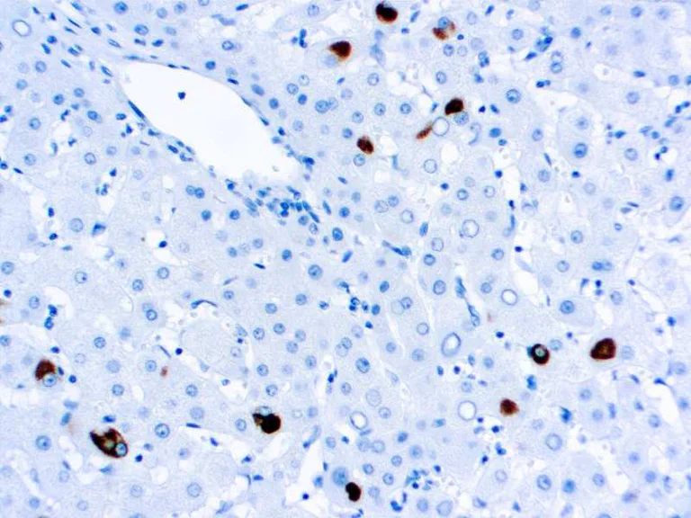 Immunohistochemistry (Formalin/PFA-fixed paraffin-embedded sections) - Anti-Hepatitis B Surface Antigen antibody [5C3] (AB277481)