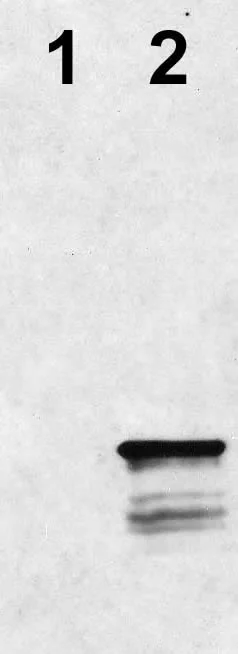 Western blot - Anti-Hepatitis B Virus Core Antigen antibody [C1] (AB8637)