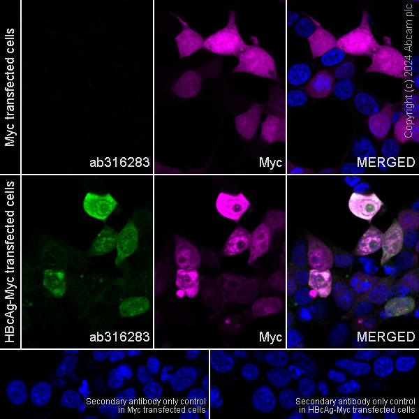 Immunocytochemistry/ Immunofluorescence - Anti-Hepatitis B Virus Core Antigen antibody [EPR28251-34] (AB316283), expandable thumbnail