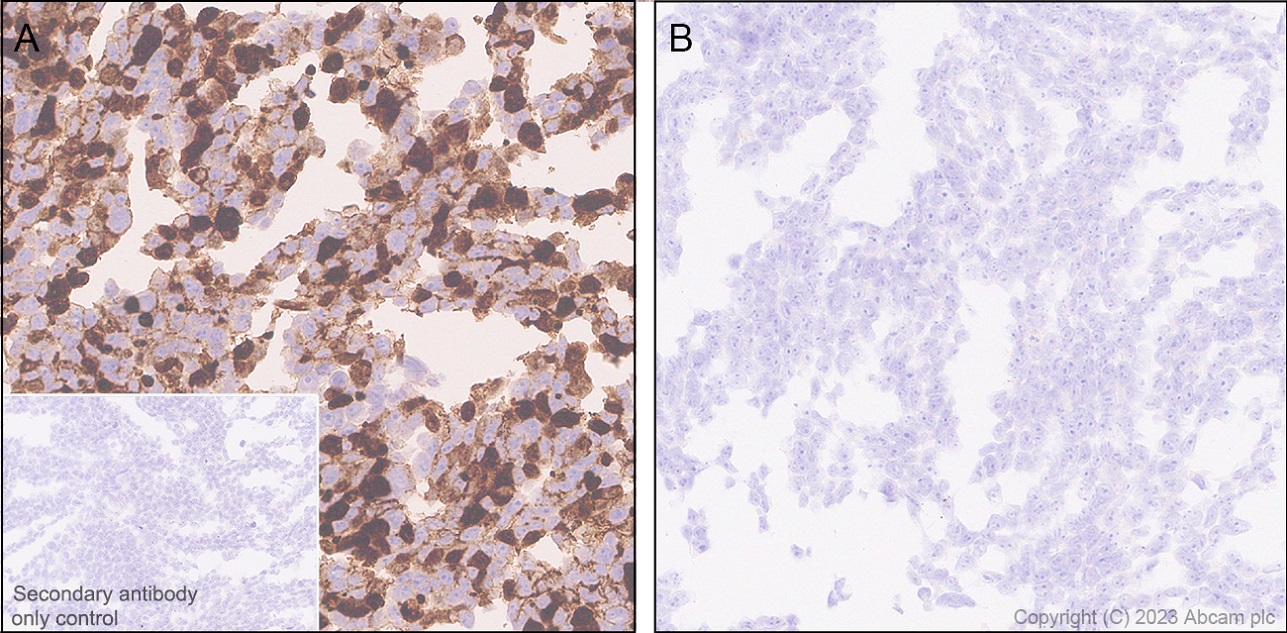 Immunohistochemistry (Formalin/PFA-fixed paraffin-embedded sections) - Anti-Hepatitis B Virus Core Antigen antibody [EPR28251-34] (ab316283), expandable thumbnail