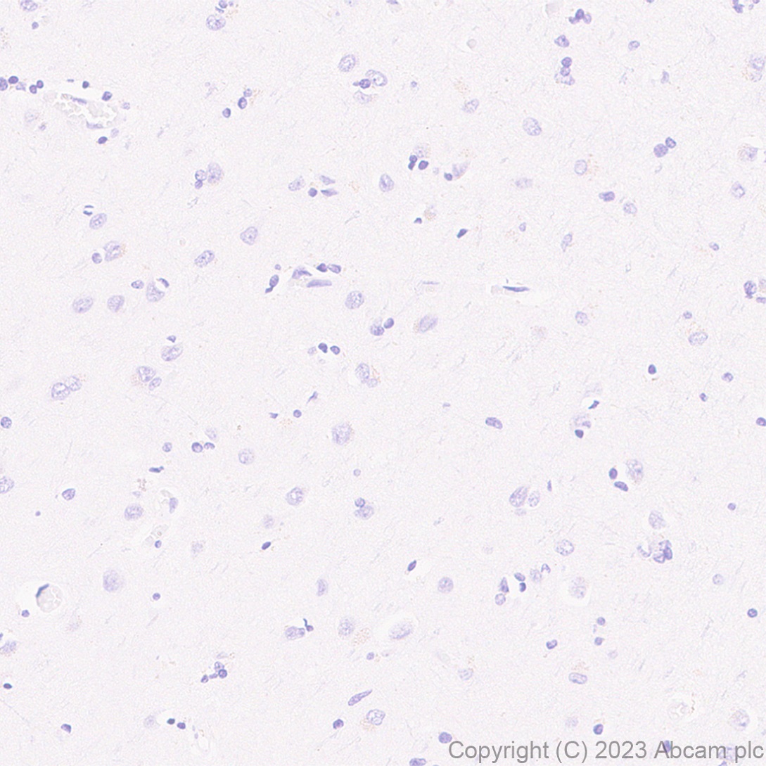 Immunohistochemistry (Formalin/PFA-fixed paraffin-embedded sections) - Anti-Hepatitis B Virus Core Antigen antibody [EPR28251-34] (ab316283), expandable thumbnail