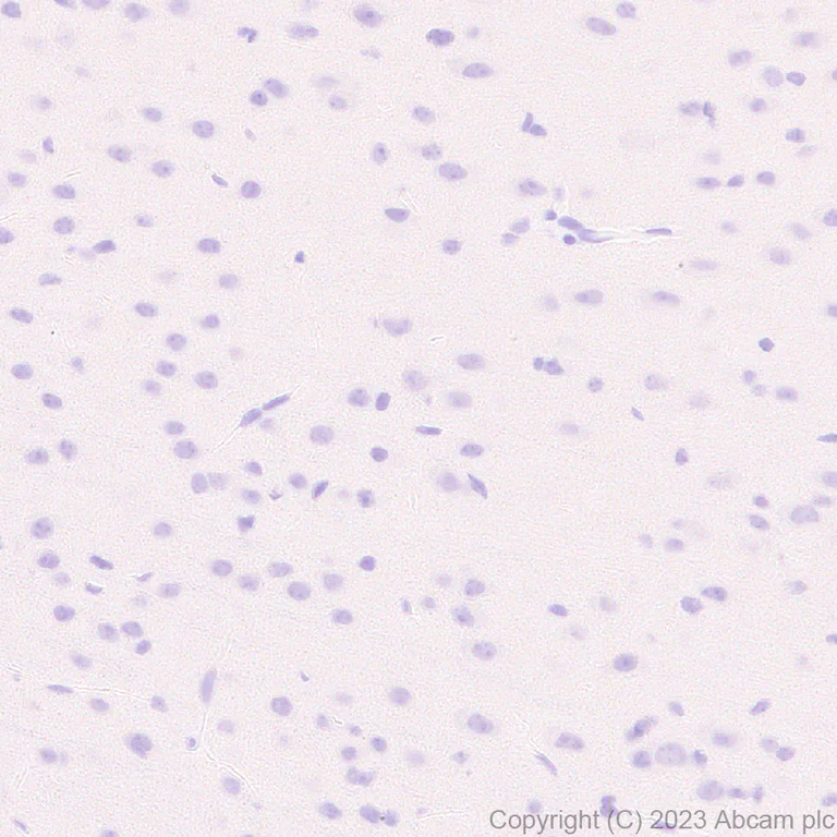 Immunohistochemistry (Formalin/PFA-fixed paraffin-embedded sections) - Anti-Hepatitis B Virus Core Antigen antibody [EPR28251-34] (AB316283)