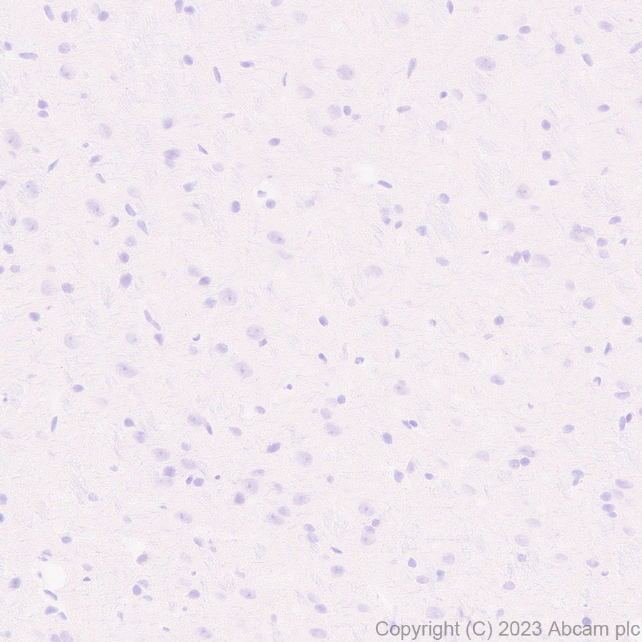 Immunohistochemistry (Formalin/PFA-fixed paraffin-embedded sections) - Anti-Hepatitis B Virus Core Antigen antibody [EPR28251-34] (ab316283), expandable thumbnail