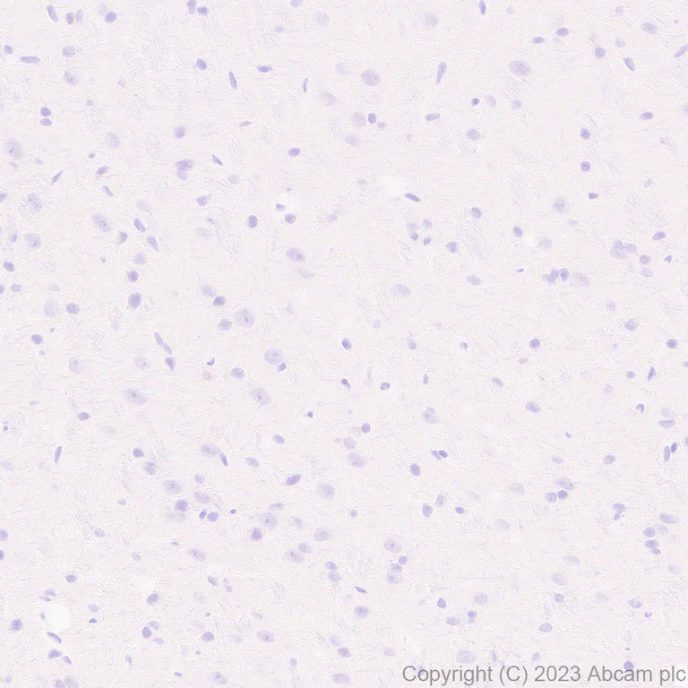 Immunohistochemistry (Formalin/PFA-fixed paraffin-embedded sections) - Anti-Hepatitis B Virus Core Antigen antibody [EPR28251-34] (AB316283)