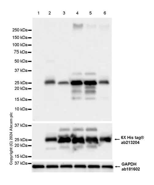 Western blot - Anti-Hepatitis B Virus Core Antigen antibody [EPR28251-34] (AB316283)